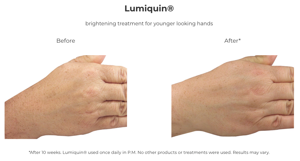 Revision Skincare Lumiquin® 1.7 oz
